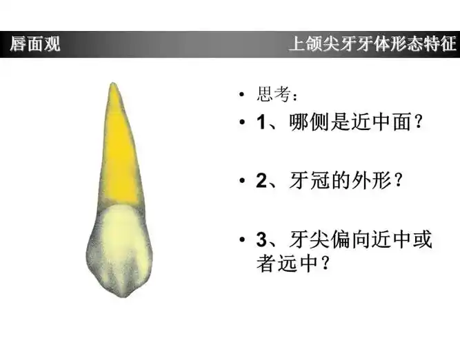 上颌尖牙牙体形态简述
