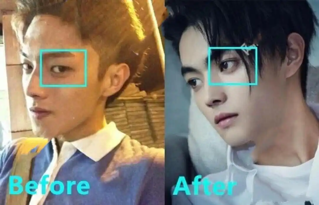 原创许凯究竟有没有整容双眼皮是揉出来的童年照一出答案自然来了