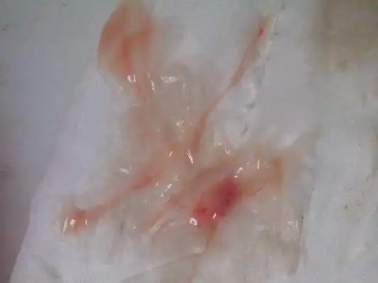 白带带血图片49