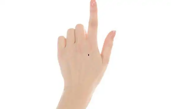 手背长痣代表什么手背有痣图解大全