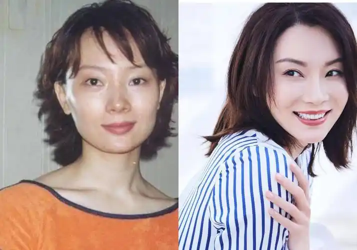 长得"歪瓜裂枣",整得"如花似玉",这些女星都靠脸逆天改命