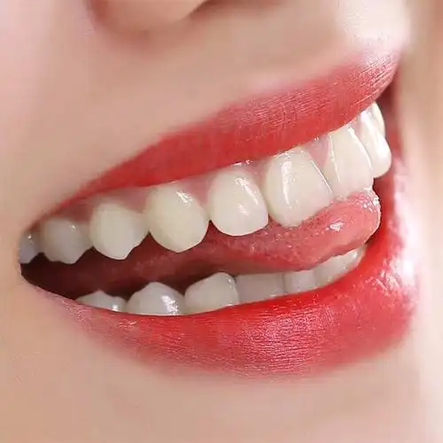 牙齿美白神器速效去黄牙烟牙斑净牙垢黑渍洗牙粉液牙贴牙膏白牙素