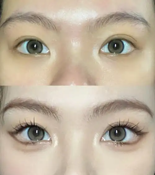 谁靠眼睑下至美美翻身教程大放送