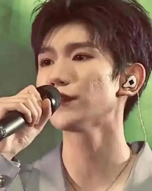 王源脸上痘痘照片,王源脸上的痘痘越发严重