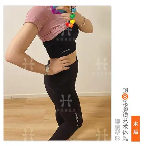 腰腹环吸##禾美嘉任学会