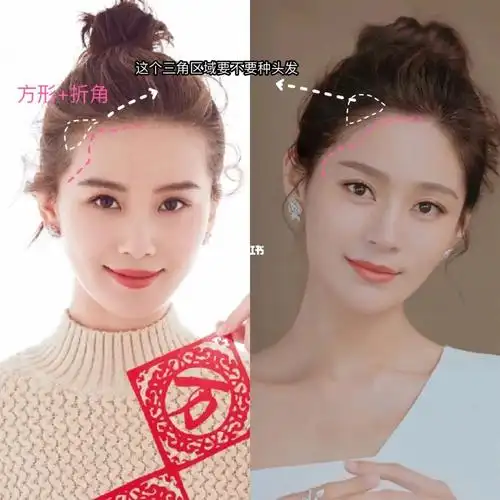 做发际线要不要填满额角往里收额头宽度呢