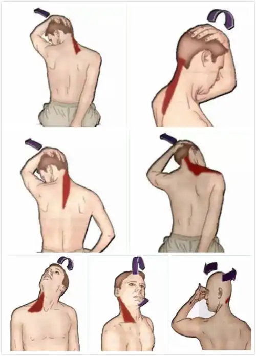 脖子疼不一定是颈椎病可能是颈肌劳损