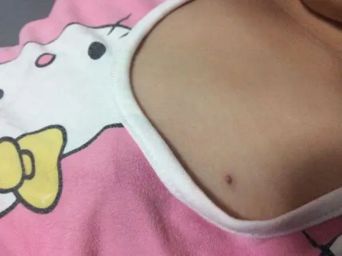 这是怎么了(在胸部上方)