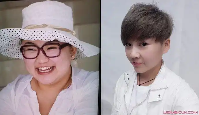 胖丫减肥前后对比照片 本山传媒胖丫因销售假药被抓