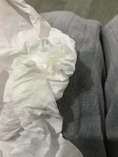 细菌性阴道炎的情况下排卵期白带是什么颜色(有图慎入)