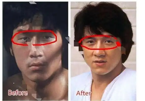 成龙双眼皮疑是割的早期单眼皮的时候和现在的差别非常大