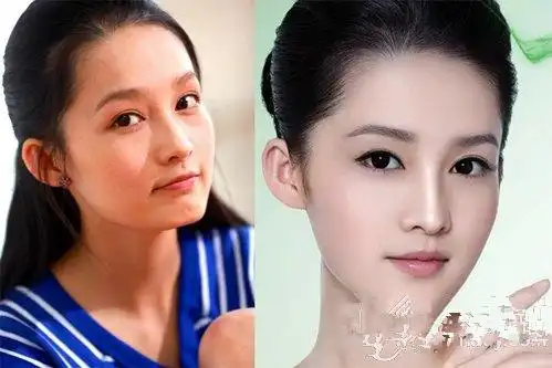 李沁整容照片对比 李沁出道前长什么样子为什么被说整容