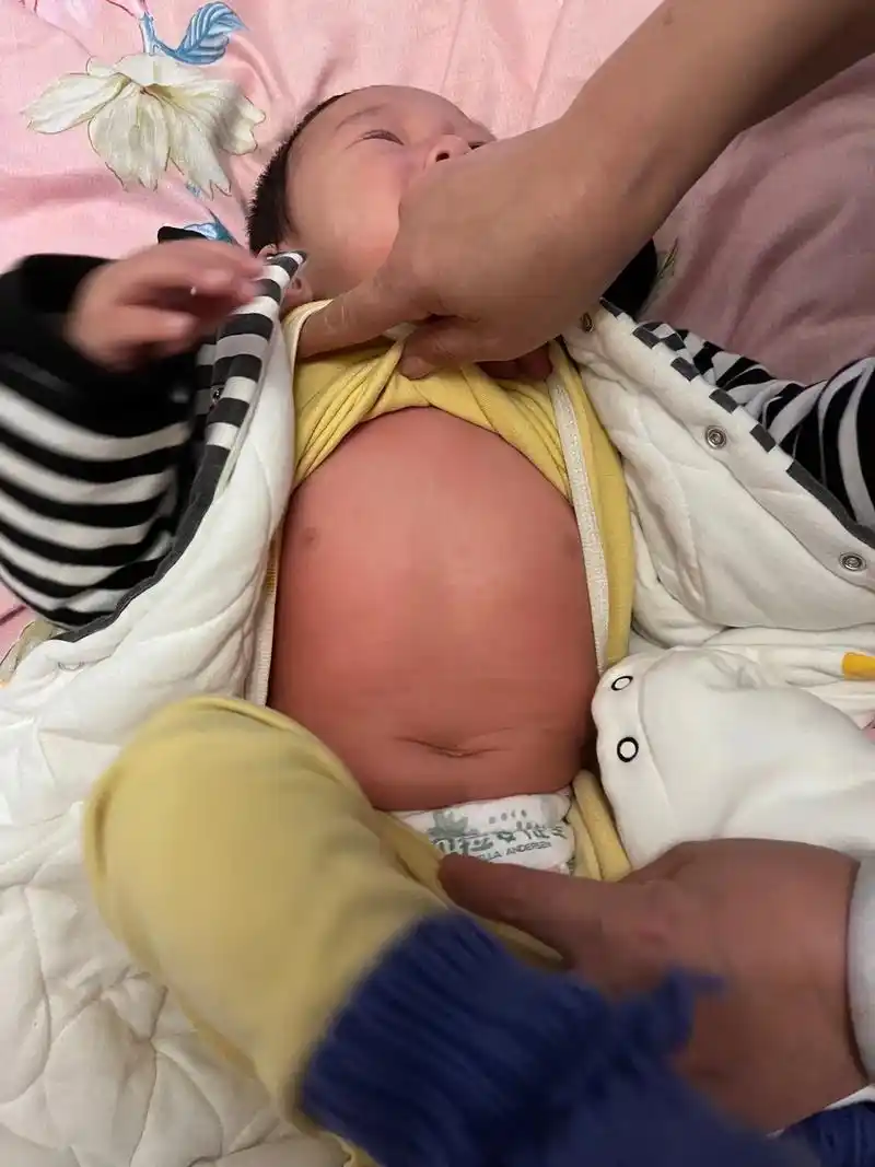 宝宝打了麻腮风疫苗  全身发红发烫  实际不图片更红  是过 - 抖音