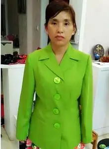 有机玻璃纽扣女装