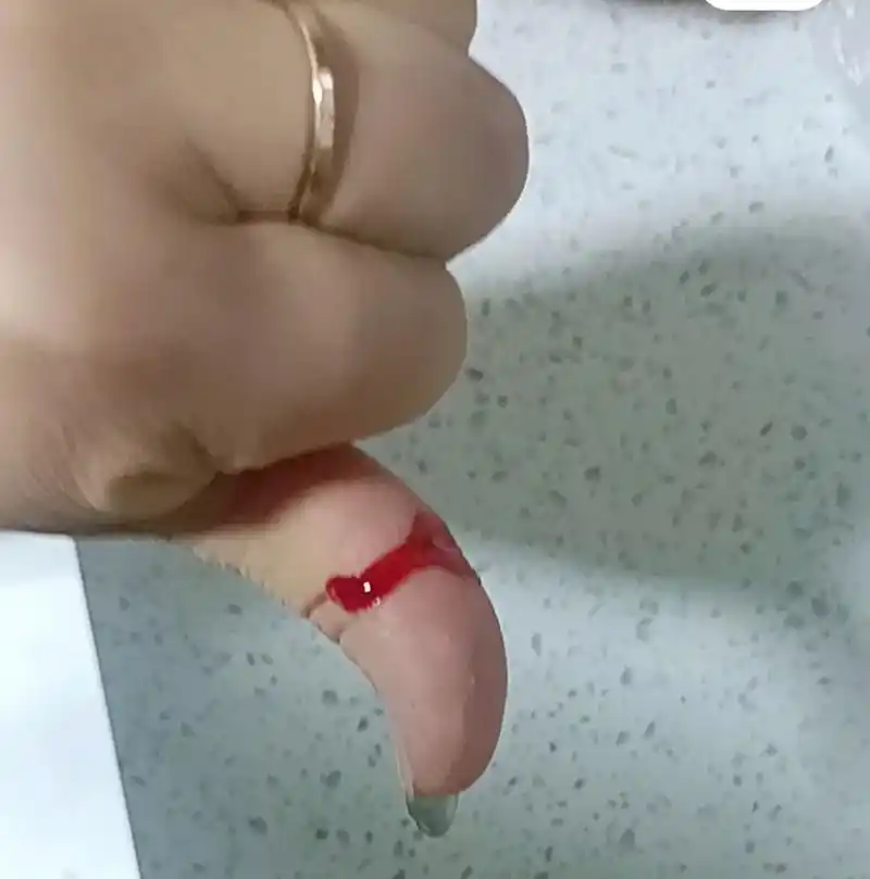 今天晚上不小心自残了一刀98 这个小伤口让我很痛很痛01 心 - 抖