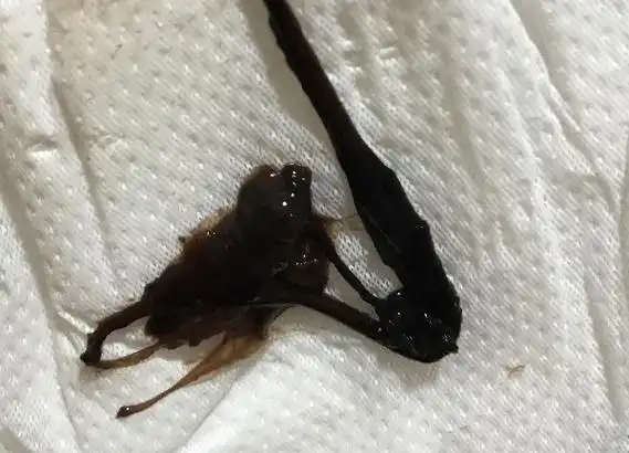 月经的血偏黑色是什么原因-图片大观-奇异网