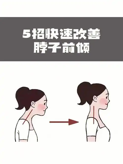 725个动作快速拯救脖子前倾