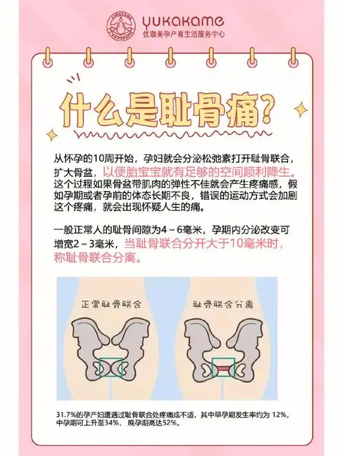 孕期耻骨痛不用慌,三个动作帮你缓解疼痛