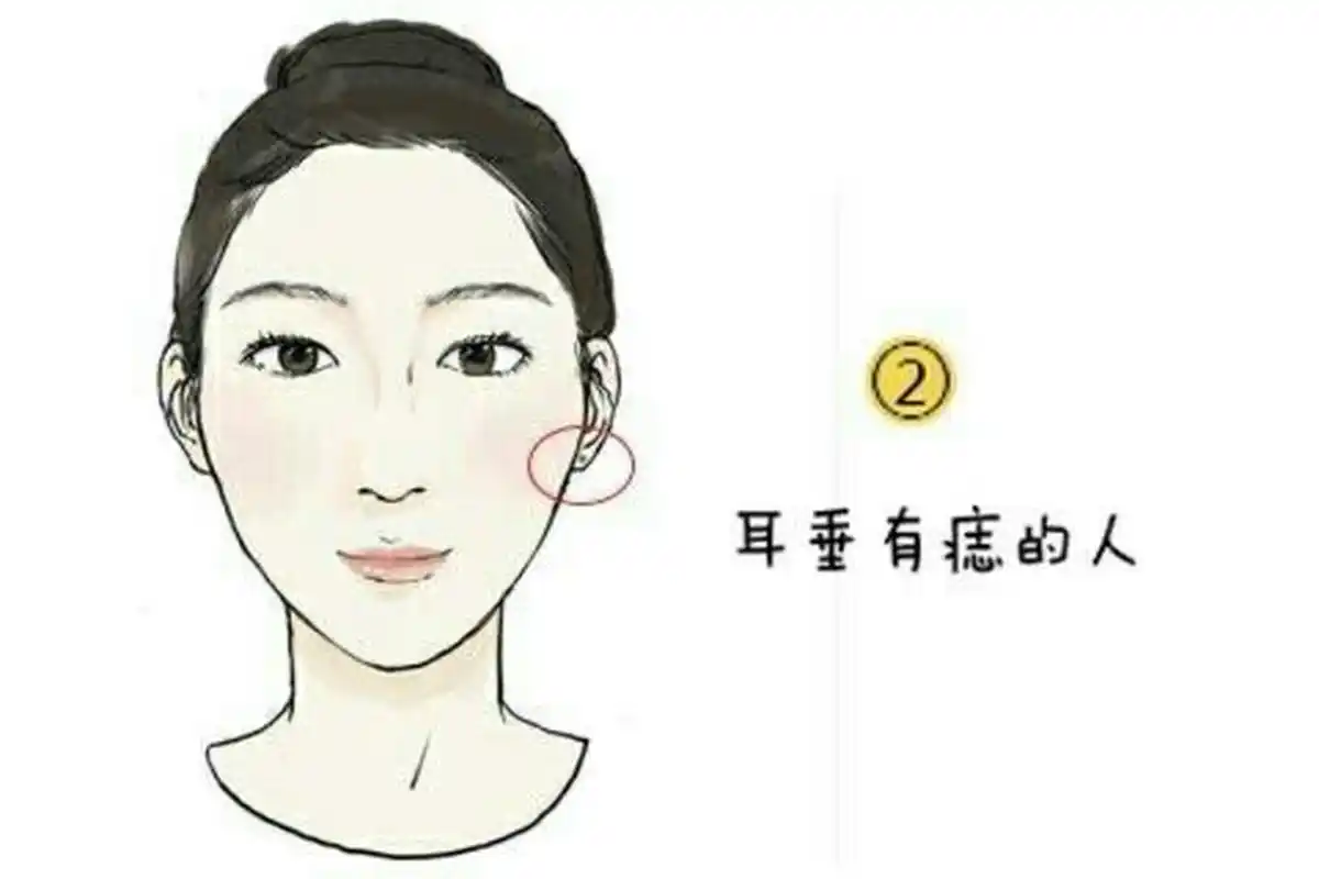 女人的汪夫痣在这儿 右耳朵有痣:为藏者为上等,意思就是痣的位置越是