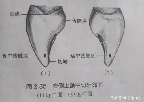 恒牙形态与功能―上颌中切牙