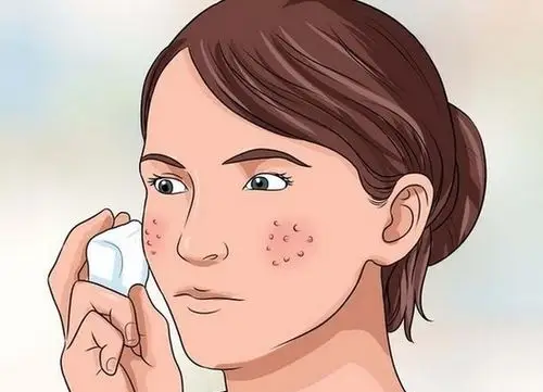 摆脱毛孔粗大和瑕疵 小妙招让你拥有清纯素颜|摆脱|毛孔-爱美·beauty