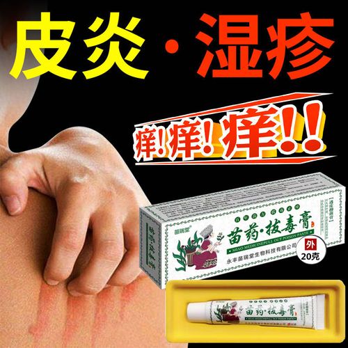 皮肤癣药膏