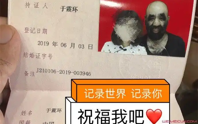 中国第一毛孩结婚了 于震寰个人资料起底老婆高颜值引热议