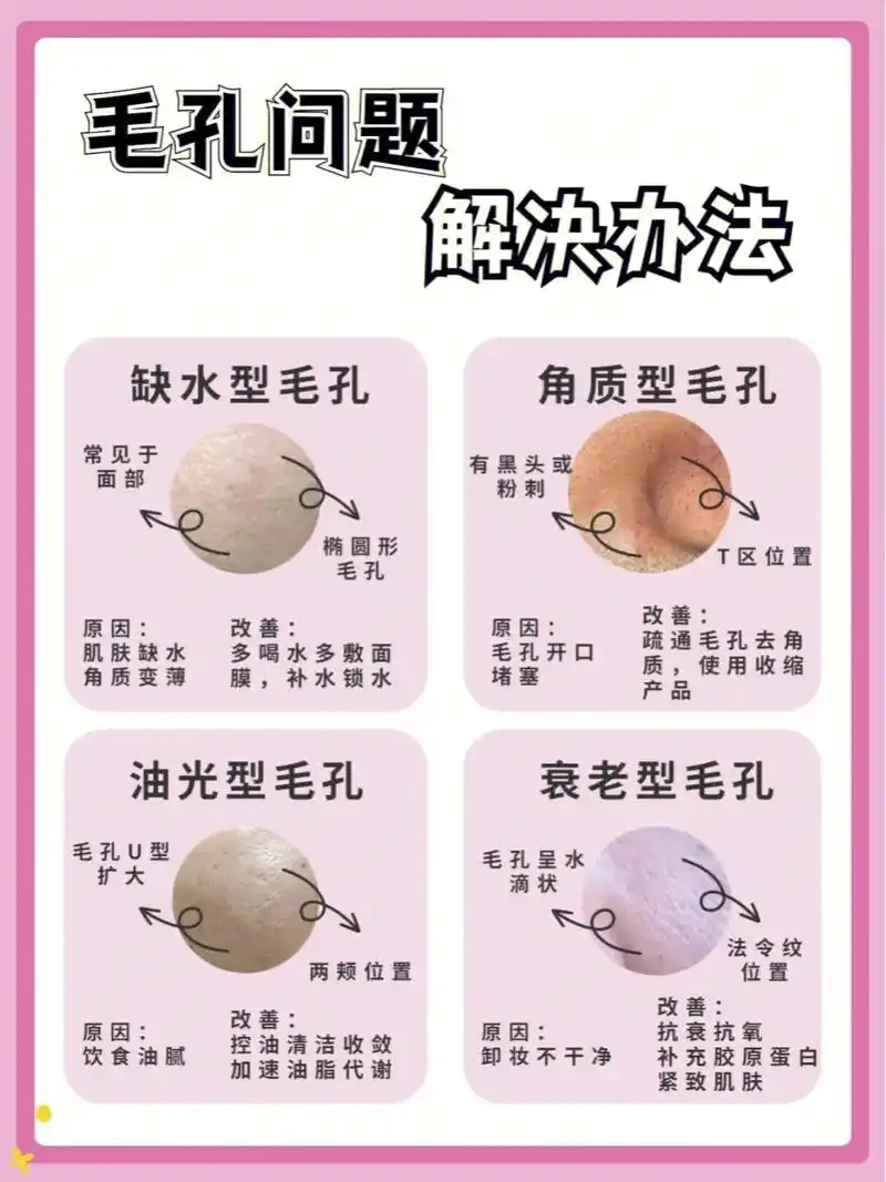 四大毛孔类型,看看自己有没有中招6015.