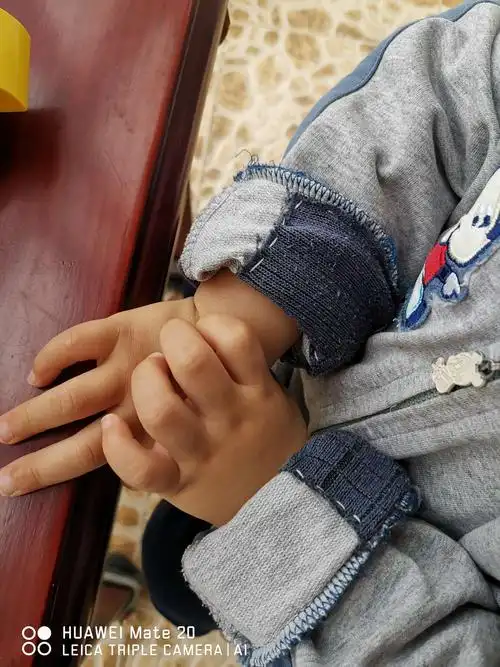 节俭典范:补丁衣服