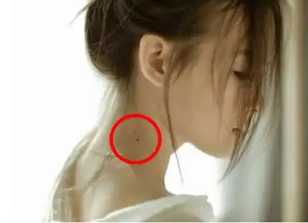 脖子上有痣图解男人女人脖子上有痣图解