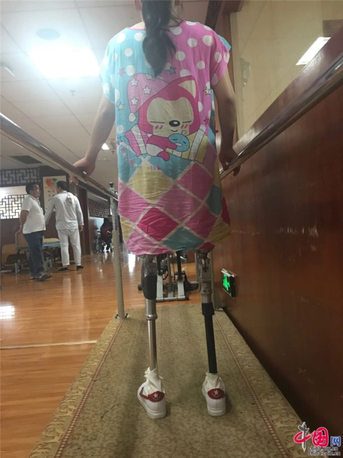 在穿脱双大腿假肢的过程中独立完成的同时还要忍受牵引带拉扯的疼痛