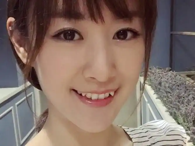 虎牙太过突出影响美观可以拔掉吗