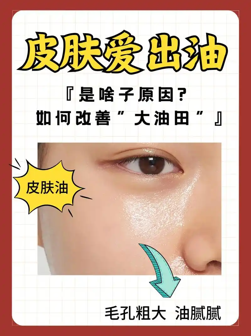 皮肤超爱出油75155个方法教你改善73油脸.