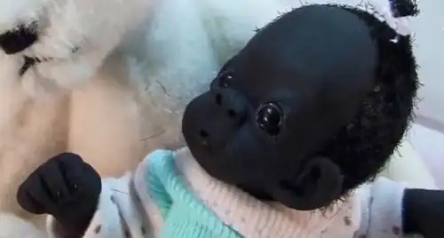 当年那个世界上最黑的婴儿现如今过得怎么样了