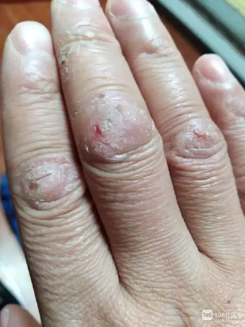 tcy~186383172的个人主页_108社区_108sq.cn