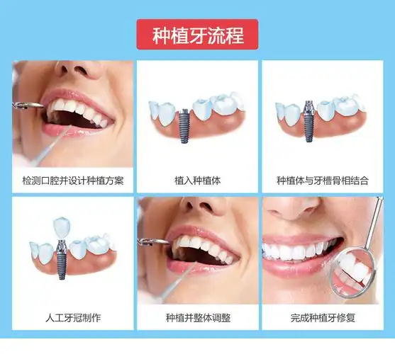 时光整形种植牙年中钜惠-19楼优惠券