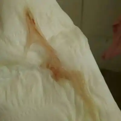 这是要生了吗,孕40 5周,宝妈一般见红会立刻医院吗,好纠纷要不要去