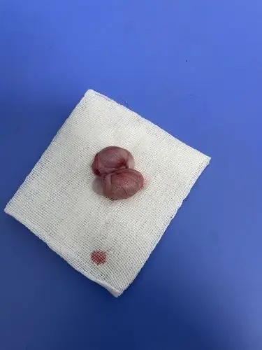 我家切完就两个球 删除 赞回应 来自 豆瓣app