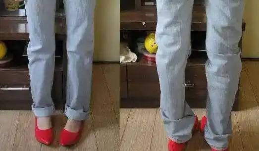 外豁脚(外八脚)俗称"外八字",走路时足尖朝外,足底相对.