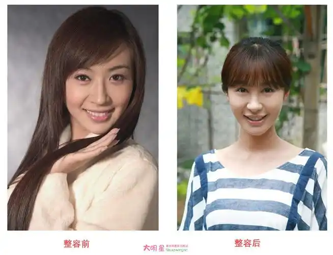 李菲儿整容传闻 李菲儿整容前后对比图