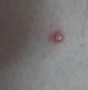 皮肤及性传播疾病讨论版 - 爱爱医医学论坛 - 爱爱医医学网