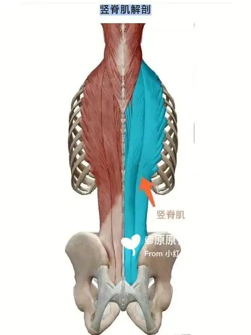 脊柱健康腰痛的根源之一竖脊肌