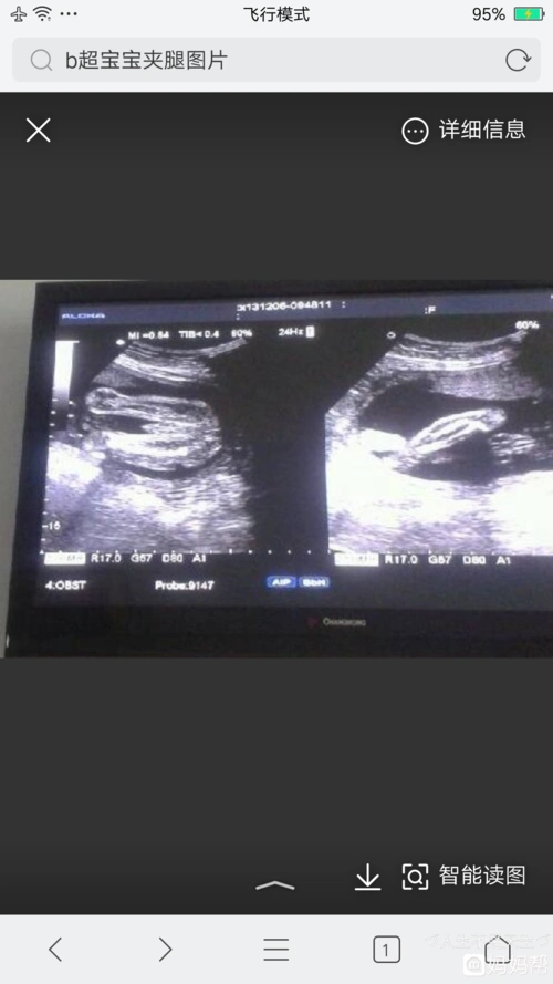 孕妇反应vs胎儿性别 说法一胎儿心率低于140次分,则所怀胎儿是男孩