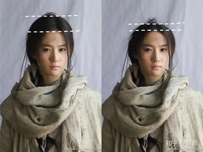 颅顶高和颅顶低的区别