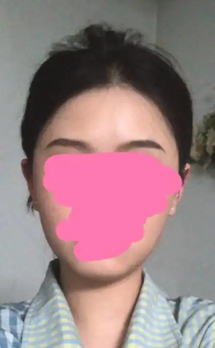 想请大家帮我看看短宽脸无下巴腮帮子又圆又方适合什么发型