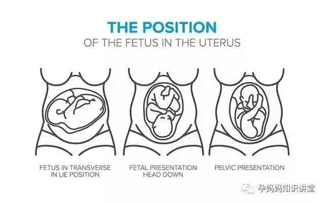 当然不是,说其舒服,哪有躺着跟坐着舒服,其实宝宝在子宫里的胎产式有