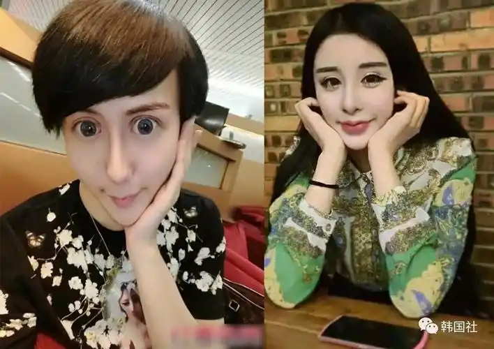 想整容?3分钟告诉你韩国整容的全过程 吓的我宁愿丑着......