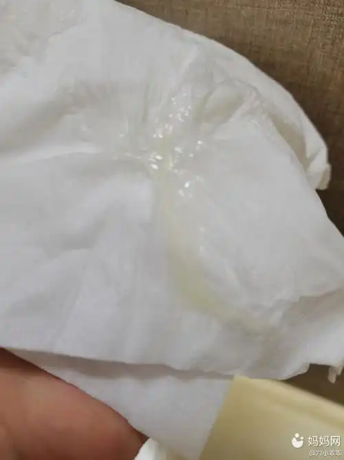 同志们,请问这是分泌物还是快要排卵的症状9090_妈妈网孕育社区