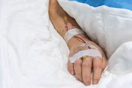 线上静脉注射生理盐水, 在重症监护病房 (icu) 病床上的老年病人手上