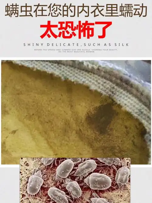 因为普通的海绵内衣穿着超过6个月 就会滋生细菌,导致螨虫的出现